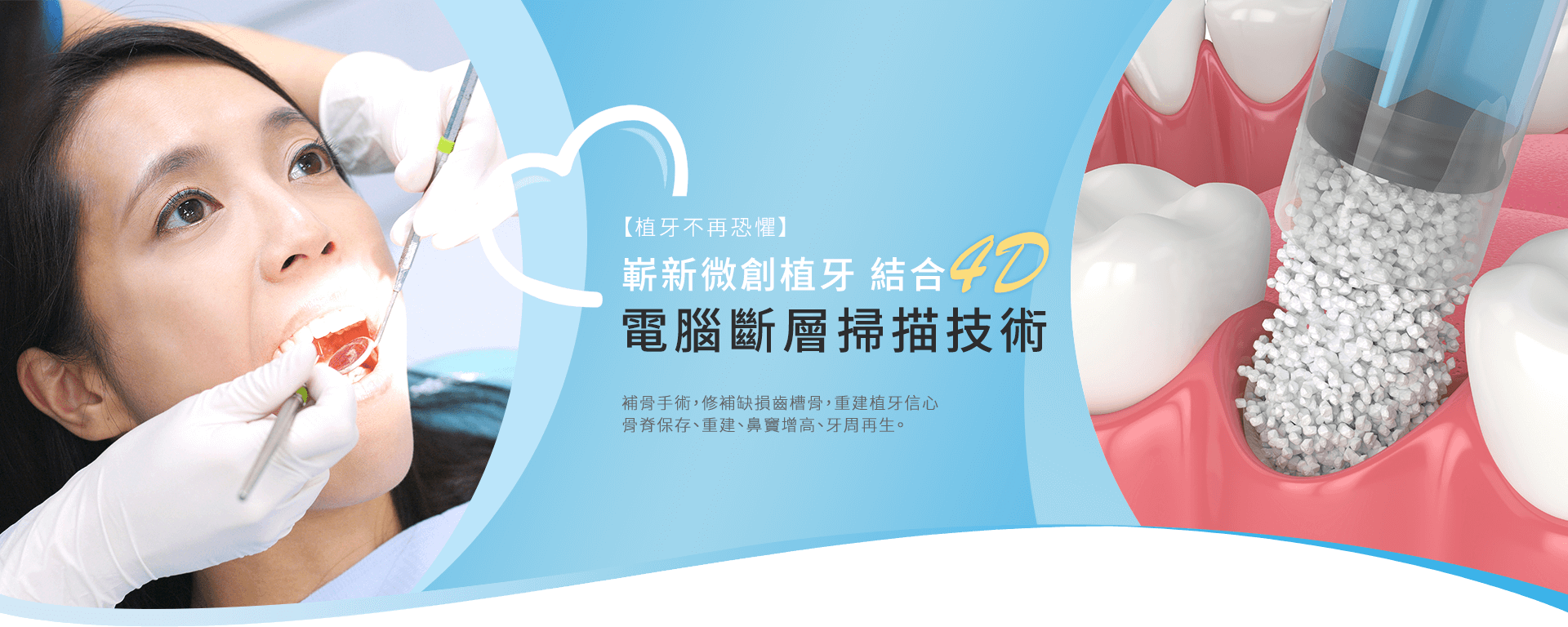 4D電腦斷層掃描科技