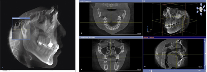 竹北植牙 竹北植牙