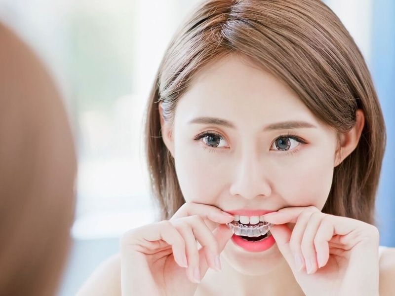 淺談齒顎矯正。