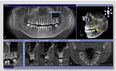 馨典牙醫最新引進3D數位電腦斷層,為患者的健康把關。 馨典牙醫最新引進3D數位電腦斷層,為患者的健康把關。